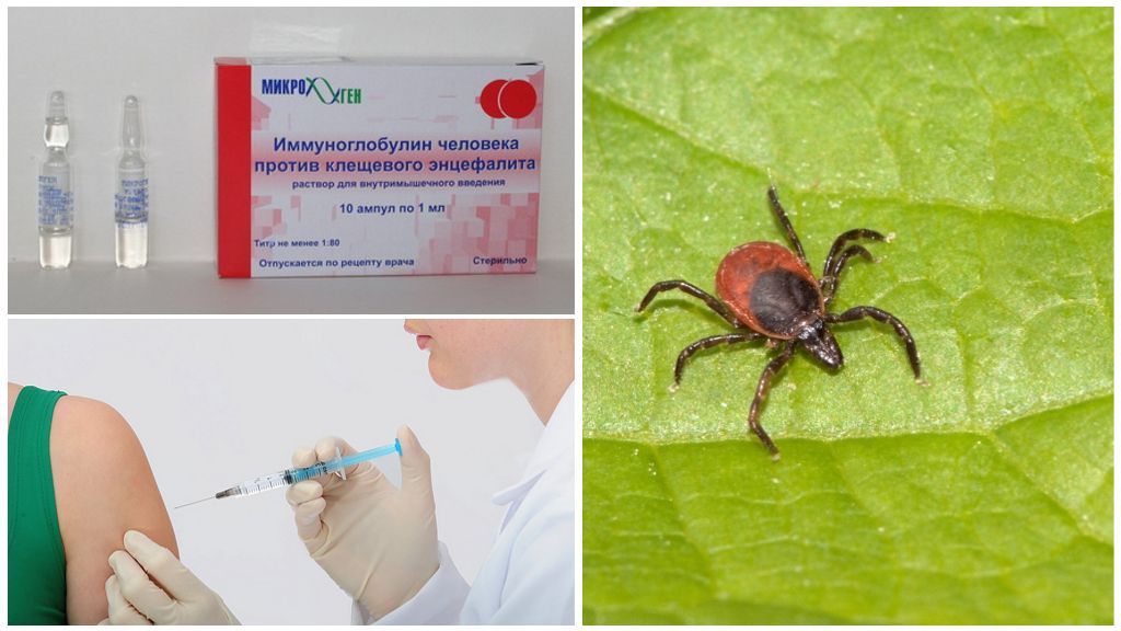 Immunoglobuline de l'encéphalite transmise par les tiques
