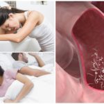 Effets de l'inérobiose