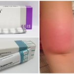 Préparations pour le traitement des allergies aux piqûres de moustiques