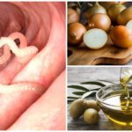 Oignons et beurre pour l'entérobiose