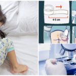 Raclage de l'entérobiose