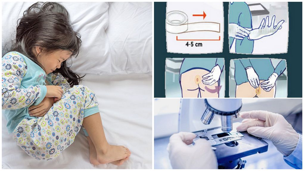 Raclage de l'entérobiose