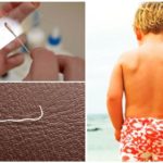 Diagnostic de l'entérobiose