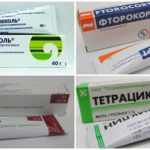 Moyens pour aider à soulager l'inflammation quand une guêpe pique