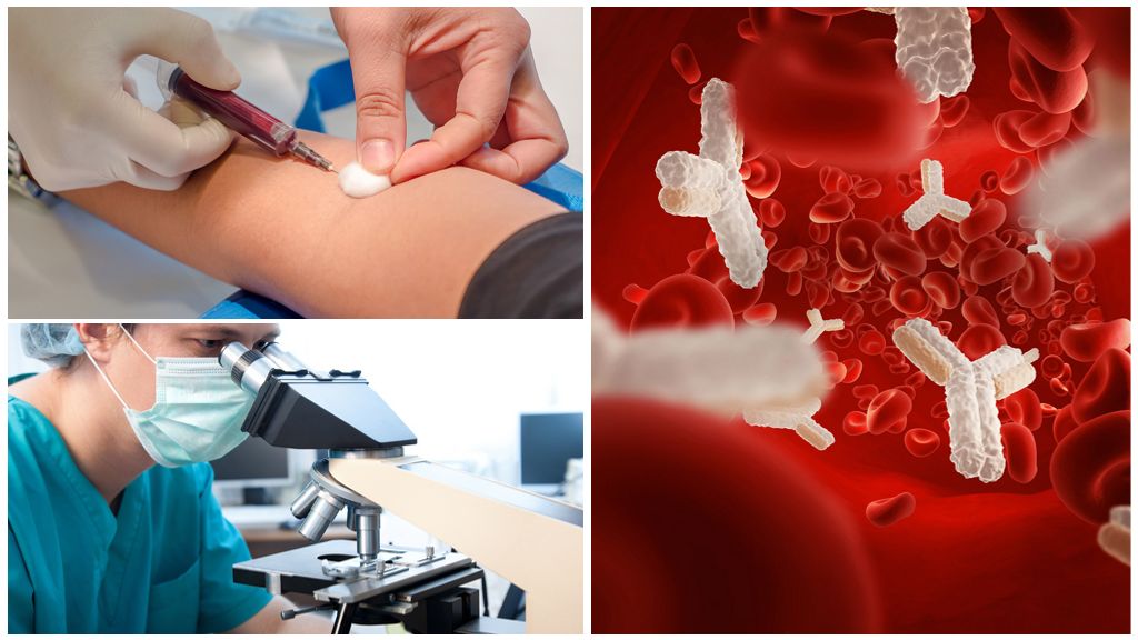 Test sanguin pour les anticorps anti-Giardia