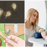 Tests de Giardia
