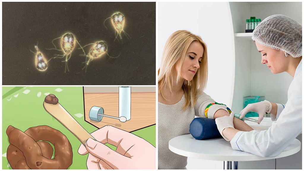 Tests de Giardia