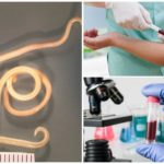 Test sanguin pour la toxocarose