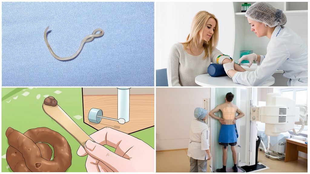 Diagnostic complet de l'ascaridiase
