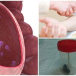 Diagnostic Giardia