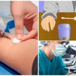 Diagnostic de la giardiase