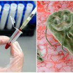 Test sanguin pour Giardia