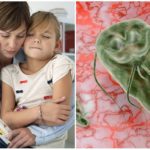 Giardiase chez les enfants