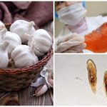 Traitement de l'aile opisthorchiase