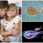 Giardia chez un enfant