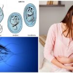 Giardiase