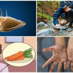 Causes de lamblia