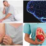Maladies concomitantes avec la giardiase