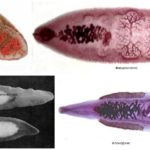 Types de douves